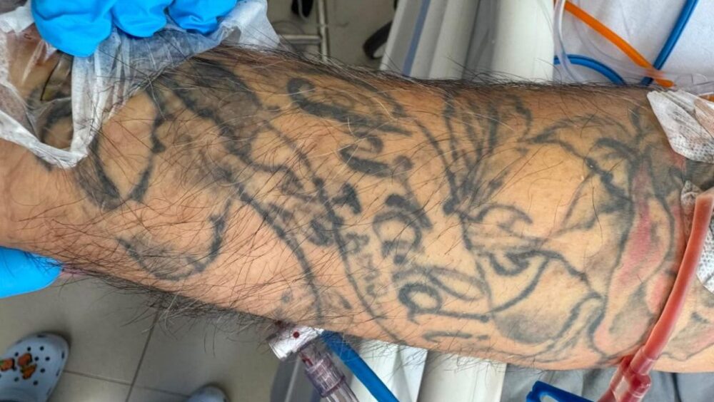 HUOP procura familiares de homem atropelado e internado desde sábado em Cascavel Imagem referente a HUOP procura familiares de homem atropelado e internado desde sábado em Cascavel
